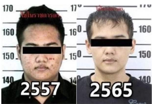 Sarahat Sawangjaeng went under the knife several times to transform his face