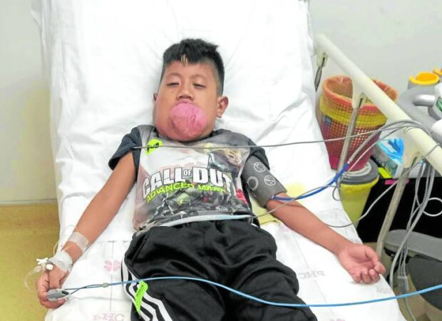 Leonardo “JR” Almazan III. The eight year old boy with a tongue tumor dreams of becoming a policeman. 