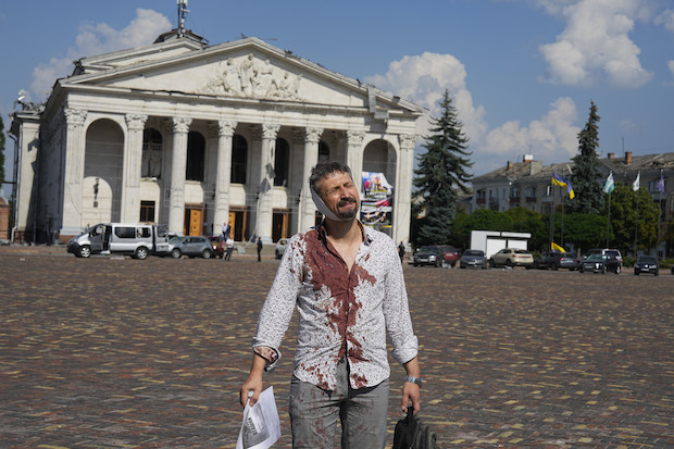 An injured man walks in Krasna square with the Taras Shevchenko Chernihiv Regional Academic Music and Drama Theatre in the background, after a Russian attack, in Chernihiv, Ukraine, Saturday, Aug. 19, 2023. 