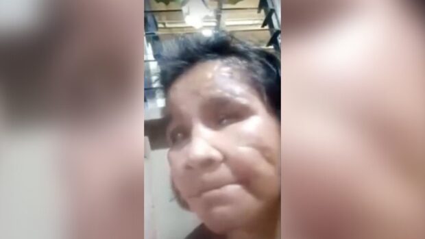 The main witness in the case of battered household help Elvie Vergara was attacked and shot by an unidentified gunman in Oriental Mindoro on Tuesday, according to police. 