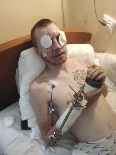 Blinded Ukrainian soldier 
