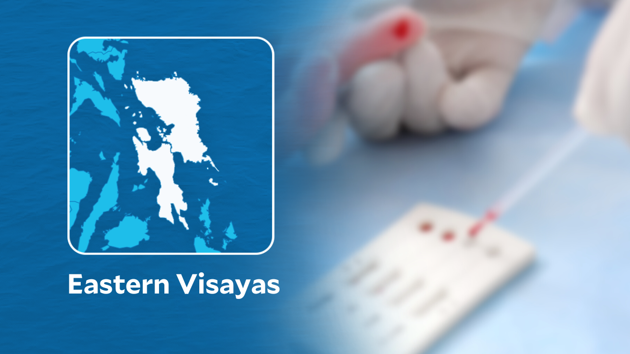 5 Eastern Visayas hospitals get HIV test machines