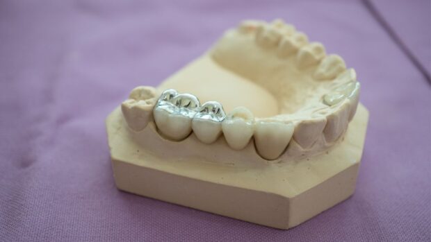 PHOTO: dental amalgam STORY: Toxic dental filling still sold despite ban, group claims