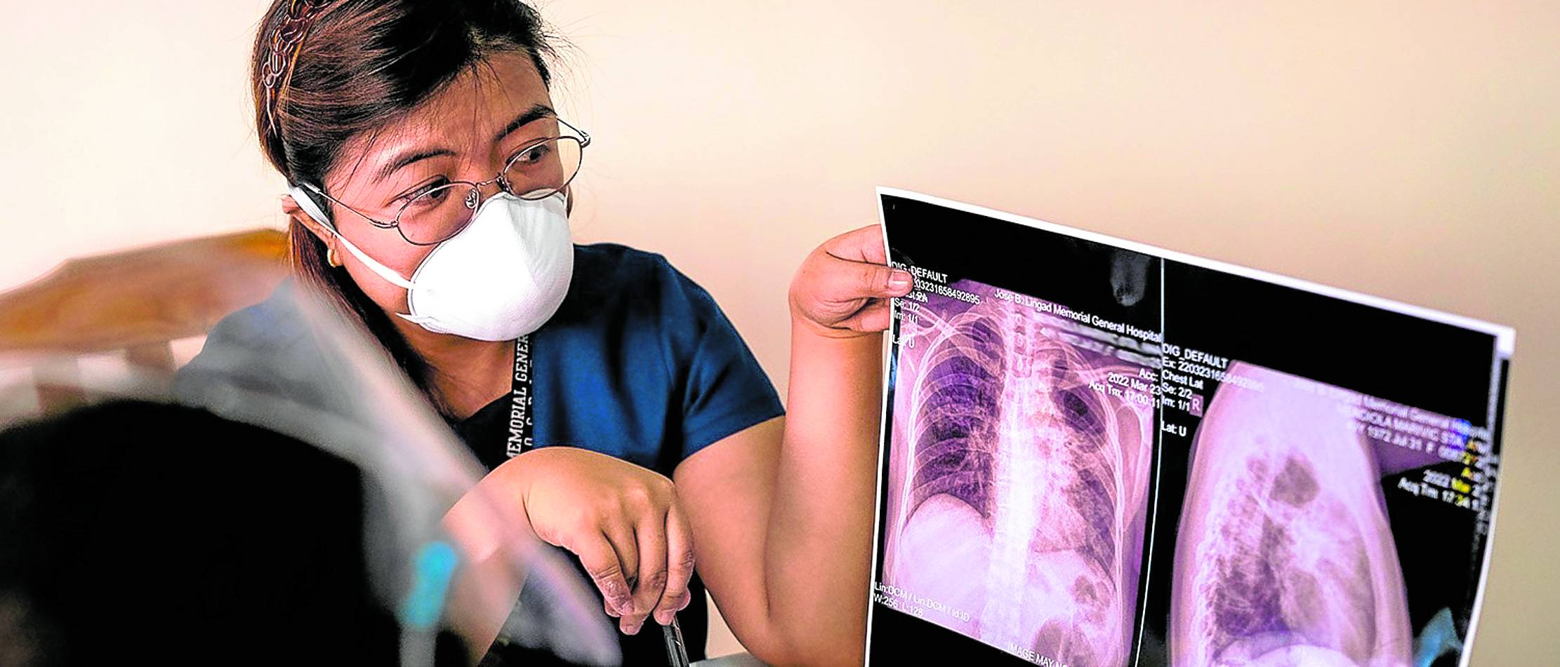 Better TB treatmentset for rollout