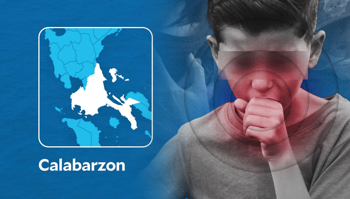 Pertussis cases continue to rise in Calabarzon, says DOH