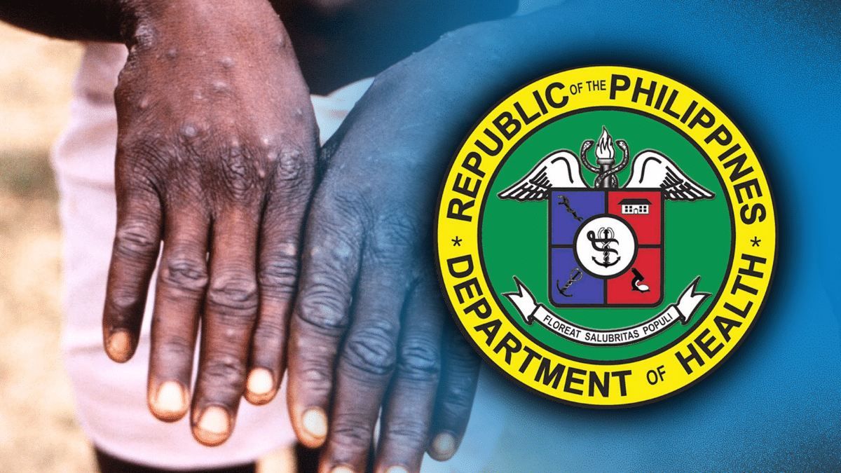 DOH updates guidelines to deal with mpox