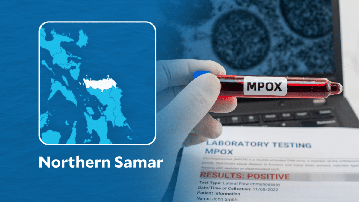 Health authorities in Northern Samar are monitoring a suspected case of mpox